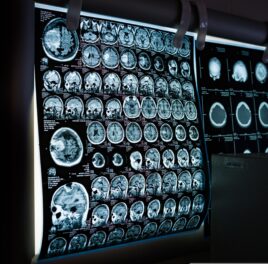 Will AI take your job? Nobody knows. Least of all the AI experts.