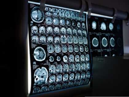 Will AI take your job? Nobody knows. Least of all the AI experts.